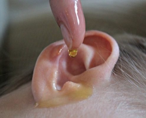 Come curare la salute delle orecchie con l’olio d’oliva
