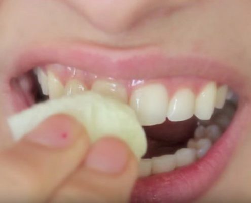 come sbiancare i denti con olio di oliva