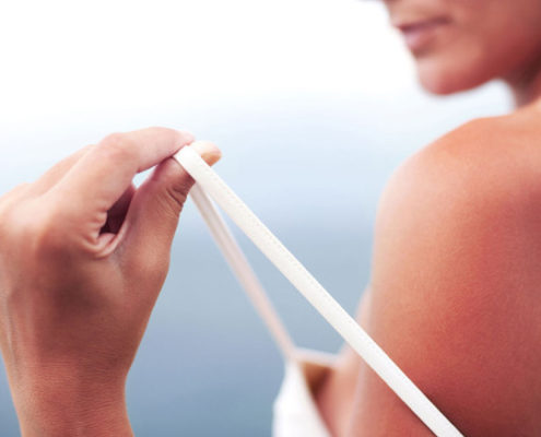 Olio di oliva contro le scottature da sole: un rimedio naturale