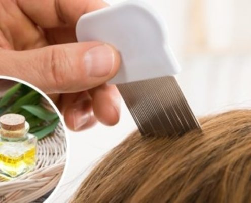 Pidocchi: un trattamento naturale all’olio extravergine di oliva!