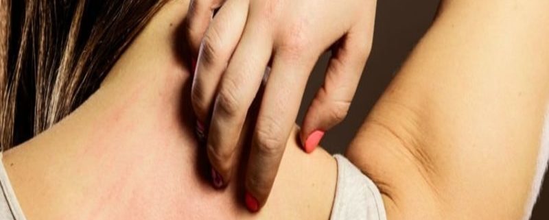 Olio evo un buon rimedio contro l’Orticaria